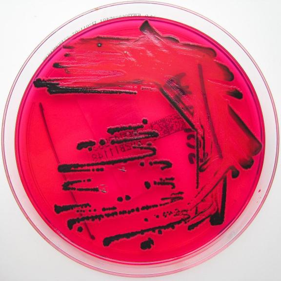 Salmonella species growing on XLD agar